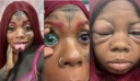 Έκανε τατουάζ στους βολβούς των ματιών της και τυφλώθηκε