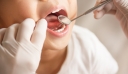 Παράταση προθεσμίας υποβολής αιτήσεων για το Dentist Pass έως 22 Δεκεμβρίου