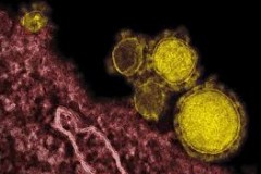 Ιός Mers: Τι πρέπει να ξέρετε για αυτόν τον ιό