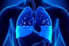 Που οφείλεται το πνευμονικό οίδημα και πόσο επικίνδυνο είναι;