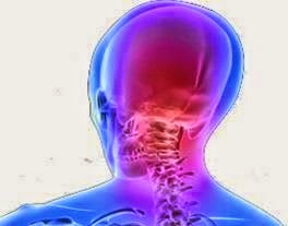 Αυχενογενής πονοκέφαλος – Πονοκέφαλος στην βάση του κρανίου… Αιτίες Συμπτώματα και αντιμετώπιση