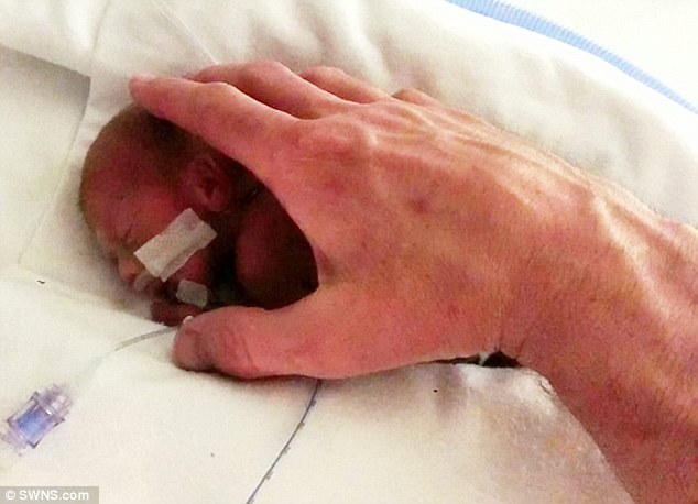 Η ιστορία που ΡΑΓΙΖΕΙ ΚΑΡΔΙΕΣ – Οι γιατροί την πίεζαν τα ρίξει το παιδί της επειδή γεννήθηκε πρόωρα και δεν τους άκουσε…[pics]