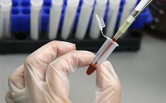 Διαδοχικά τεστ αίματος ανιχνεύουν τον καρκίνο των ωοθηκών – Υγεία
