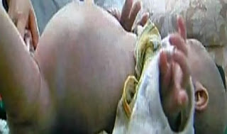 Η κοιλιά αυτού του μωρού άρχισε να φουσκώνει…  Όταν μάθαμε την αιτία σοκαριστήκαμε!! [βίντεο]
