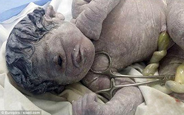 Μωρό κύκλωπας γεννήθηκε στην Αίγυπτο – Σοκαριστική φωτογραφία!
