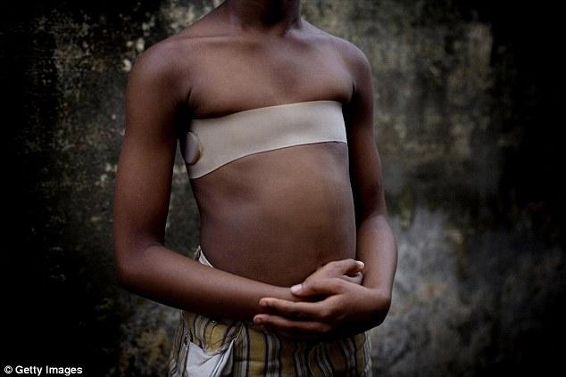 Αφρική: Εκατομμύρια γυναίκες αυτοακρωτηριάζονται για να μην πέσουν θύματα βιασμών