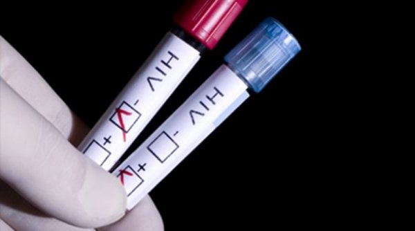 Φάρμακο κατά του αλκοολισμού «ξετρυπώνει» τον κρυμμένο στα κύτταρα ιό HIV του AIDS