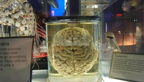 23χρονος έκλεβε και πουλούσε διατηρημένους ανθρώπινους εγκεφάλους από μουσείο στις ΗΠΑ
