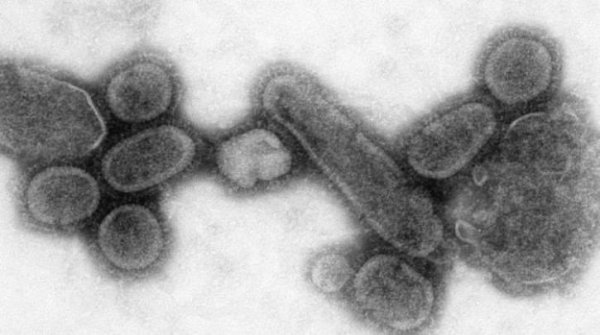 10 νεκροί από τον ιό της γρίπης H1N1