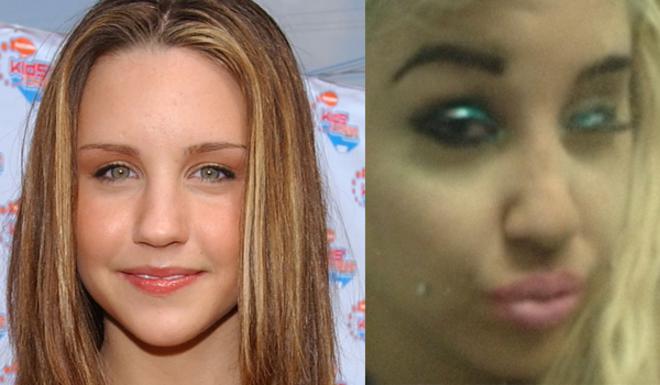 15 celebrities πριν και μετά τη χρήση ναρκωτικών [photos]