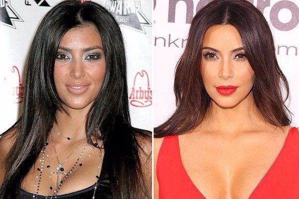 Οι πλαστικές των Kardashian και οι αλλαγές στην εμφάνιση (φωτό)