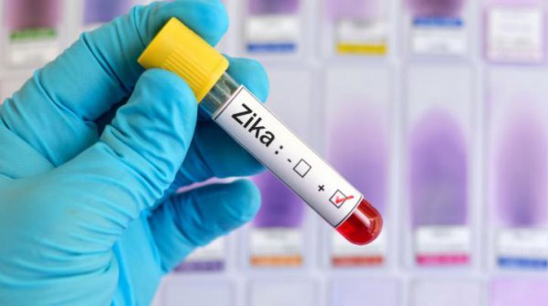 Η Βραζιλία επιβεβαιώνει 1.581 περιστατικά μικροκεφαλίας που σχετίζονται με τον ιό Ζίκα