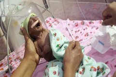 Γονείς-ΤΕΡΑΤΑ εγκατέλειψαν αβοήθητο το νεογέννητο παιδί τους επειδή είχε ρυτίδες [εικόνες & βίντεο]