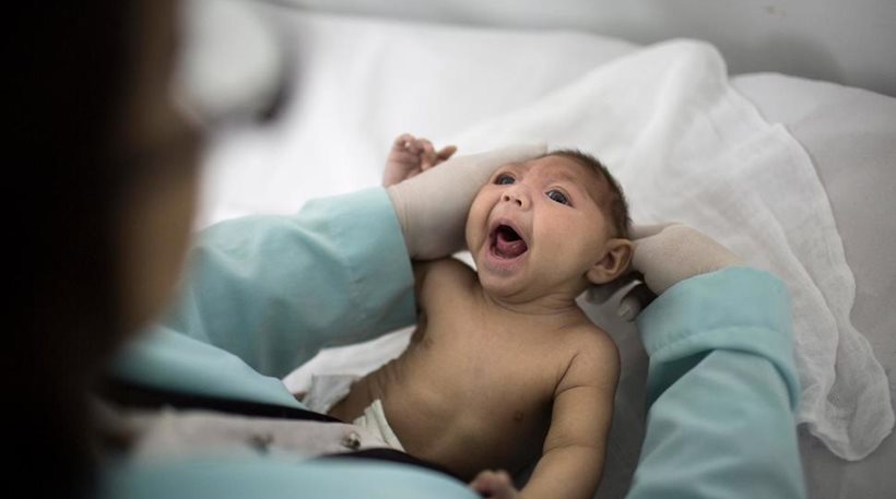 Στην Ισπανία το πρώτο μωρό με μικροκεφαλία από τον Ζήκα