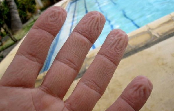 Γιατί ζαρώνουν τα δάχτυλά σας όταν είναι πολλή ώρα μέσα στο νερό