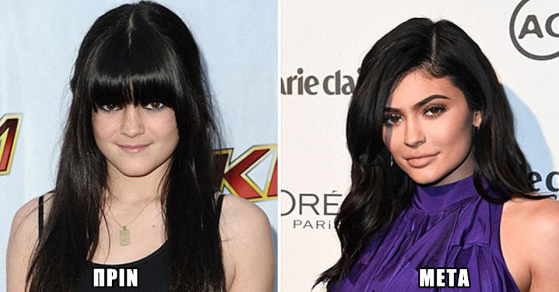 13 διάσημοι πριν και μετά την εφηβεία (εικόνες)