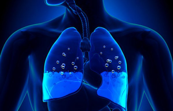 Τα «μικρά» συμπτώματα που δείχνουν συσσώρευση υγρού στον πνεύμονα