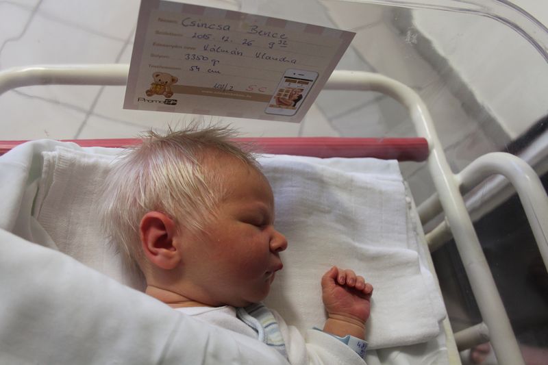 Μωρό γεννήθηκε με Άσπρα Μαλλιά στο Κεφάλι και οι Γιατροί δεν μπορούν να το εξηγήσουν!