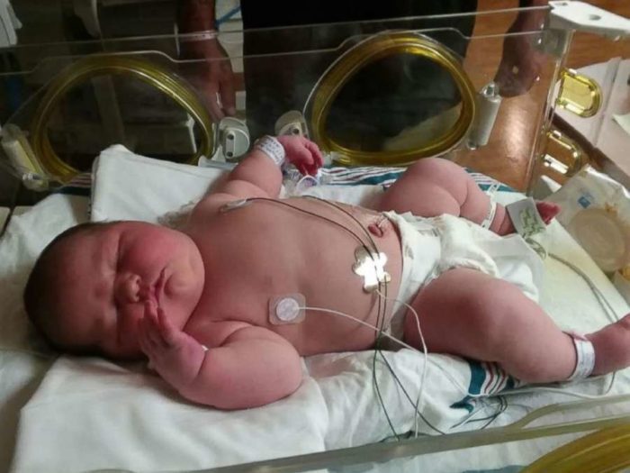 Γέννησε υγιέστατο μωρό 6 κιλών και οι φωτογραφίες του έχουν ξετρελάνει