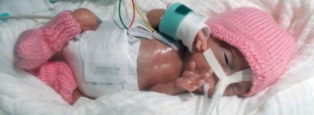 Το μικρότερο νεογέννητο στον κόσμο επιβίωσε με βάρος μόλις 200 γραμάρια και το πόδι του είχε το μέγεθος από ένα δάχτυλο