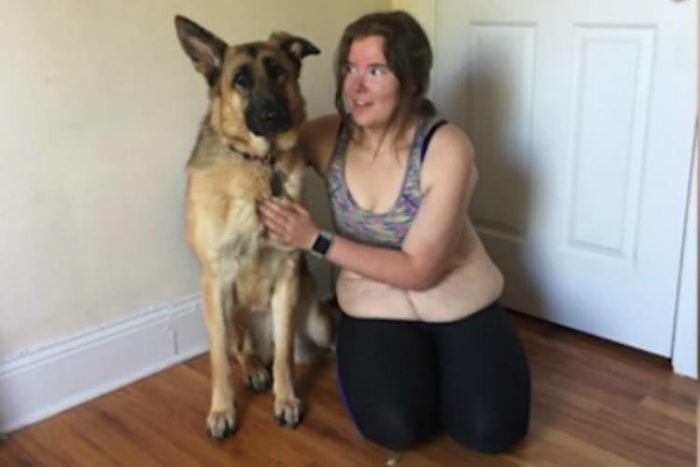 Είχε φτάσει τα 160 κιλά μέχρι που ξεκίνησε καθημερινό τρέξιμο με τον σκύλο της. Απλά δείτε την απίστευτη μεταμόρφωσή της!