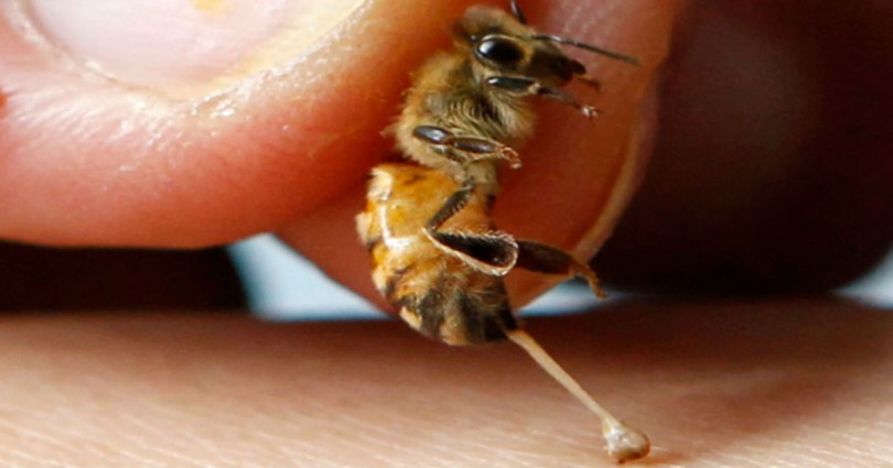Τσίμπημα από μέλισσα ή σφήκα: Τι συμβαίνει στο σώμα και πώς το χειριζόμαστε
