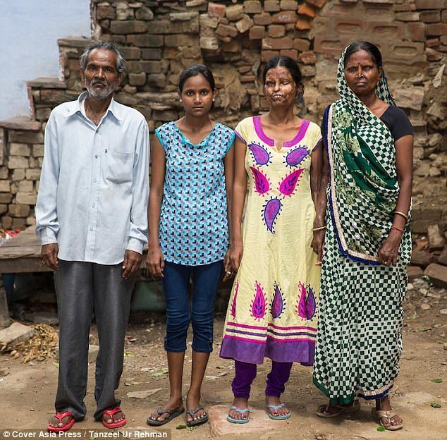 Μητέρα και κόρη συνεχίζουν να ζουν με τον άνδρα που τις παραμόρφωσε με οξύ λόγω φτώχειας