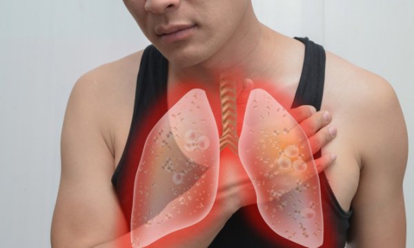 Καρκίνος του πνεύμονα και βήχας. Ποια είναι η σύνδεση;