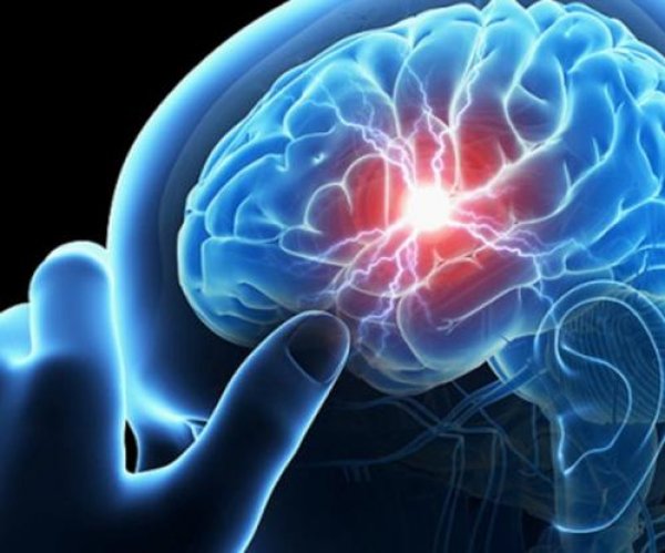Εγκεφαλικό: Αυτά είναι τα συμπτώματα