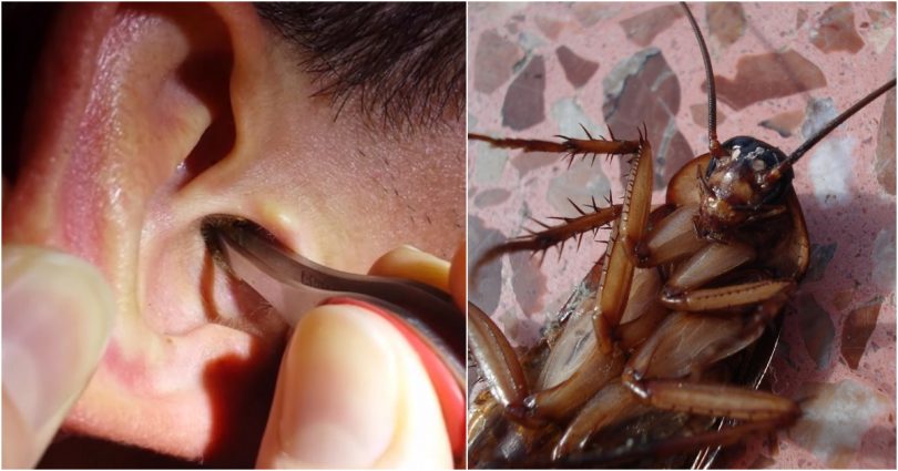 Εφιαλτική αποκάλυψη: Κατσαρίδες μπαίνουν στα αυτιά ανθρώπων όταν κοιμούνται και γεννάνε αυγά μέσα