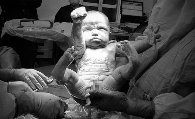 Το μωρό-Σούπερμαν: Viral έγινε η πρώτη φωτογραφία της ζωής του