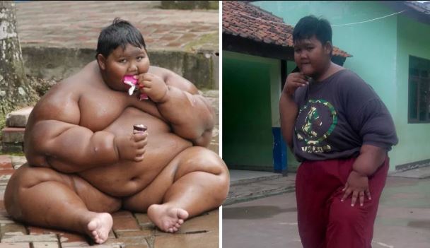 Το πιο χοντρό παιδί του κόσμου έχασε 106 κιλά και άλλαξε η ζωή του [φωτο+βίντεο]