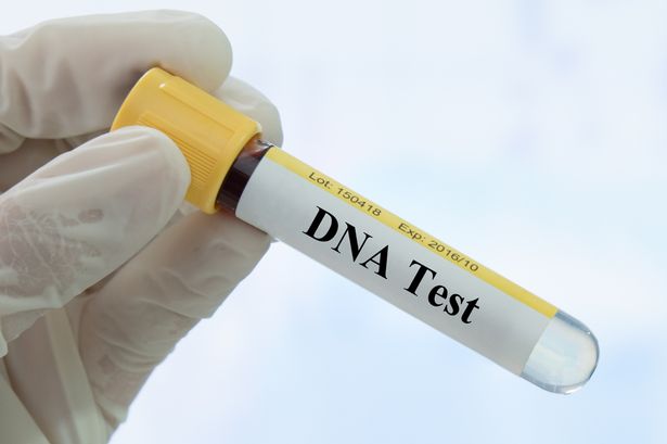 Ζευγάρι αποφάσισε να κάνει τεστ DNA για πλάκα – Τελικά το αποτέλεσμα τους χώρισε