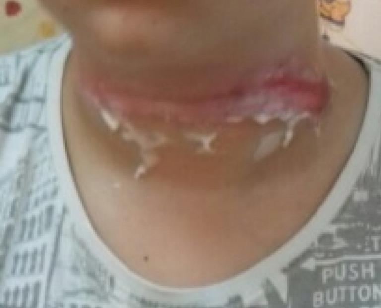 Ηράκλειο: Το σχοινί της παρέλασης παραλίγο να σκοτώσει 13χρονο