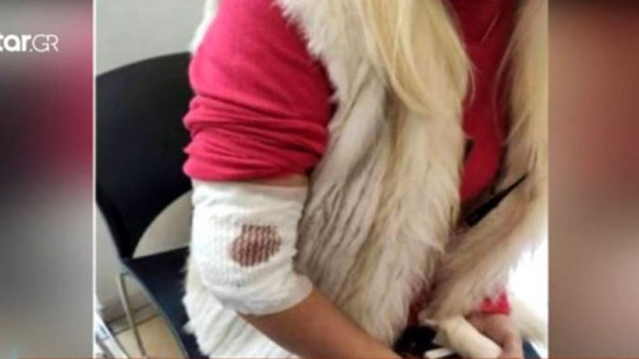 Αδέσποτος σκύλος επιτέθηκε σε γυναίκα στη Λαμία