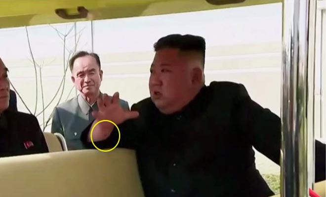 Κιμ Γιονγκ Ουν: Η «επιστροφή» και το μυστηριώδες σημάδι στο δεξί του χέρι
