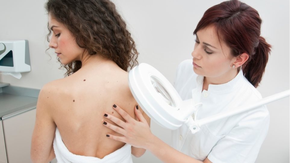 Μελάνωμα του δέρματος: Το πρώτο τεστ που εντοπίζει όσους δεν κινδυνεύουν με μετάσταση του καρκίνου