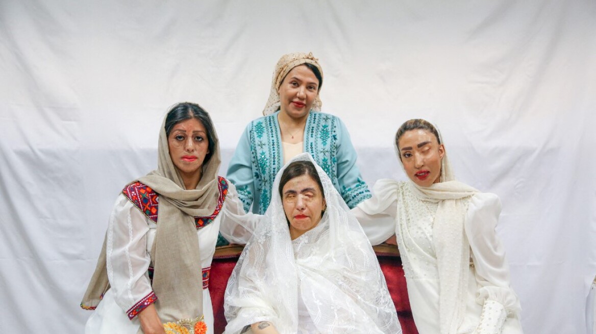 Ιρανή σχεδιάστρια μόδας επιλέγει ως μοντέλα γυναίκες που έπεσαν θύματα επιθέσεων με οξύ