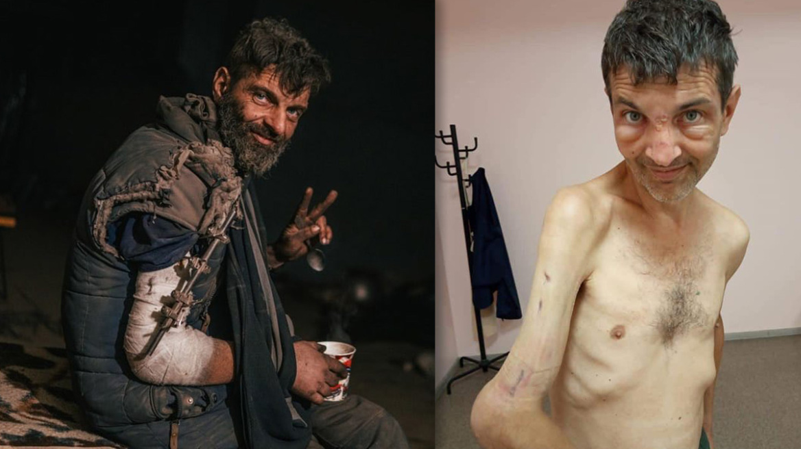 Πόλεμος στην Ουκρανία: Συγκλονίζει η εικόνα αποστεωμένου Ουκρανού στρατιώτη που αιχμαλωτίστηκε στη Μαριούπολη
