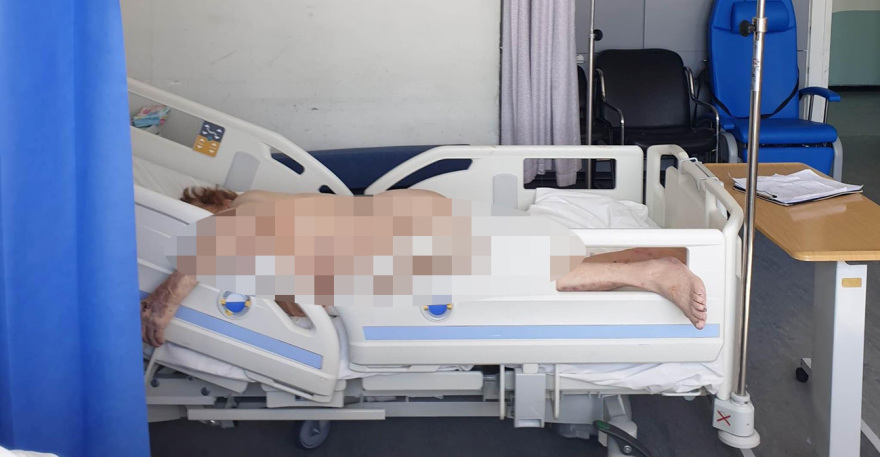 Κύπρος: Εικόνα ντροπής σε κρατικό νοσοκομείο – Ηλικιωμένη έχει αφεθεί γuμνή πάνω στο κρεβάτι