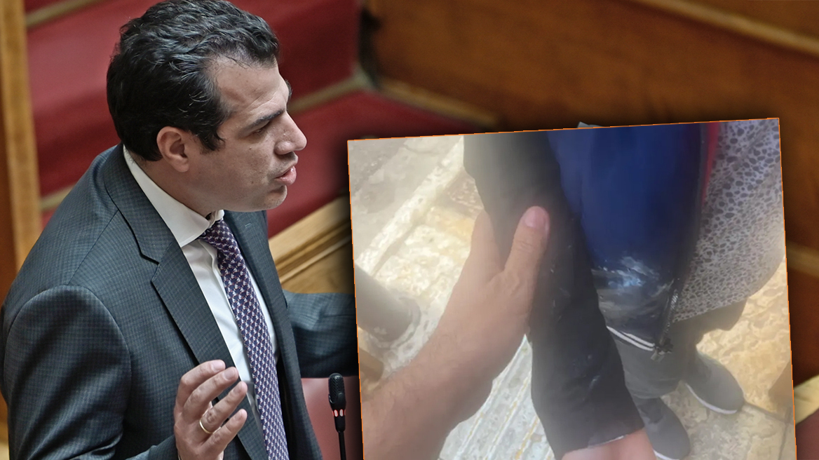 Θάνος Πλεύρης: Καταδίκη για την επίθεση με γιαούρτια – Για αφωνία καταγγέλλει τον ΣΥΡΙΖΑ η ΝΔ